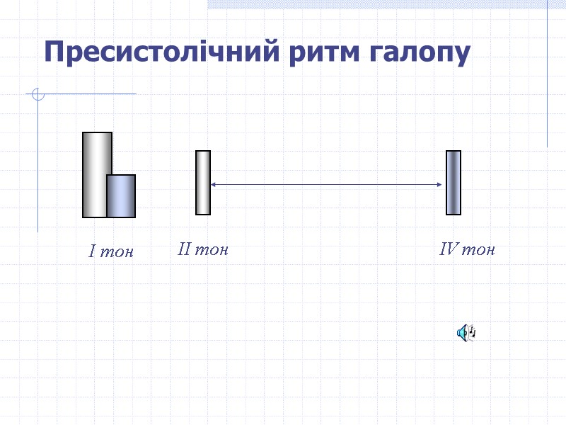 Пресистолічний ритм галопу